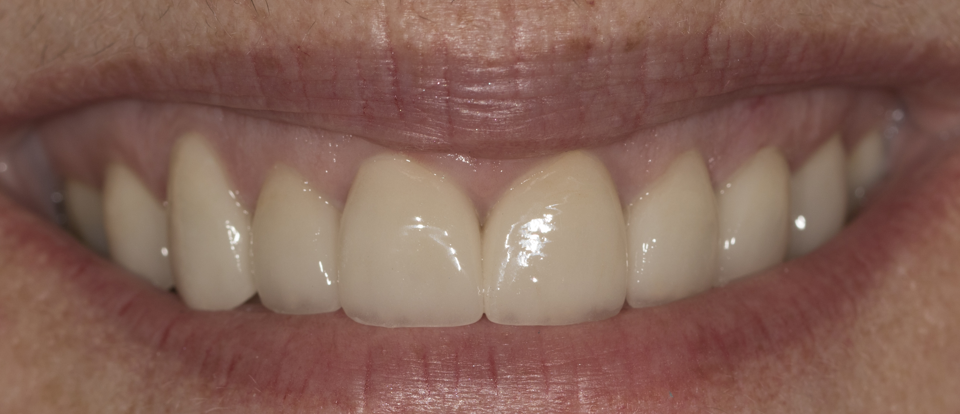 Cosmetic Dentistry